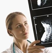 Osteokondroz tanısı bir X -Ray muayenesi kullanılarak belirtilmiştir.